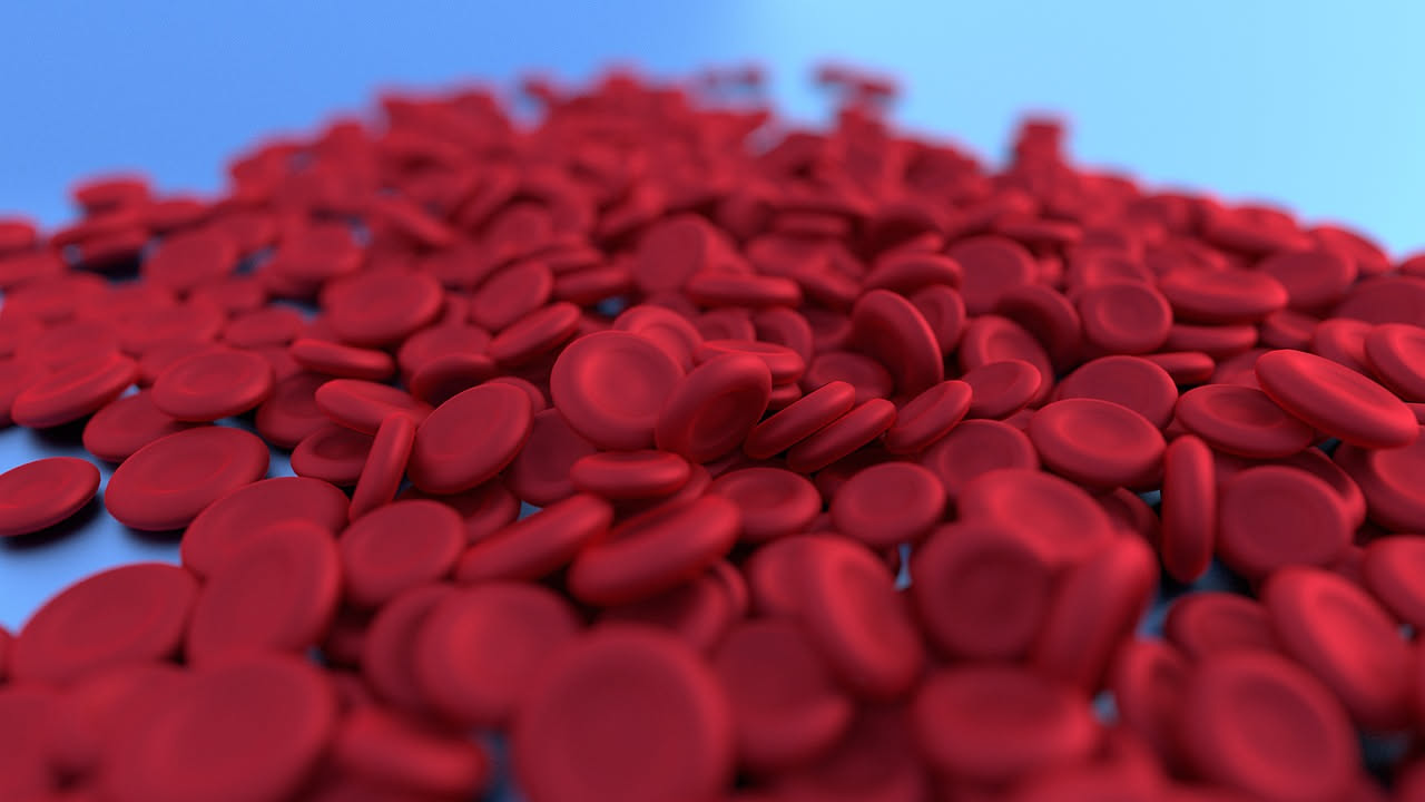 Anemia da carenza di ferro: quali cibi facilitano l'assorbimento