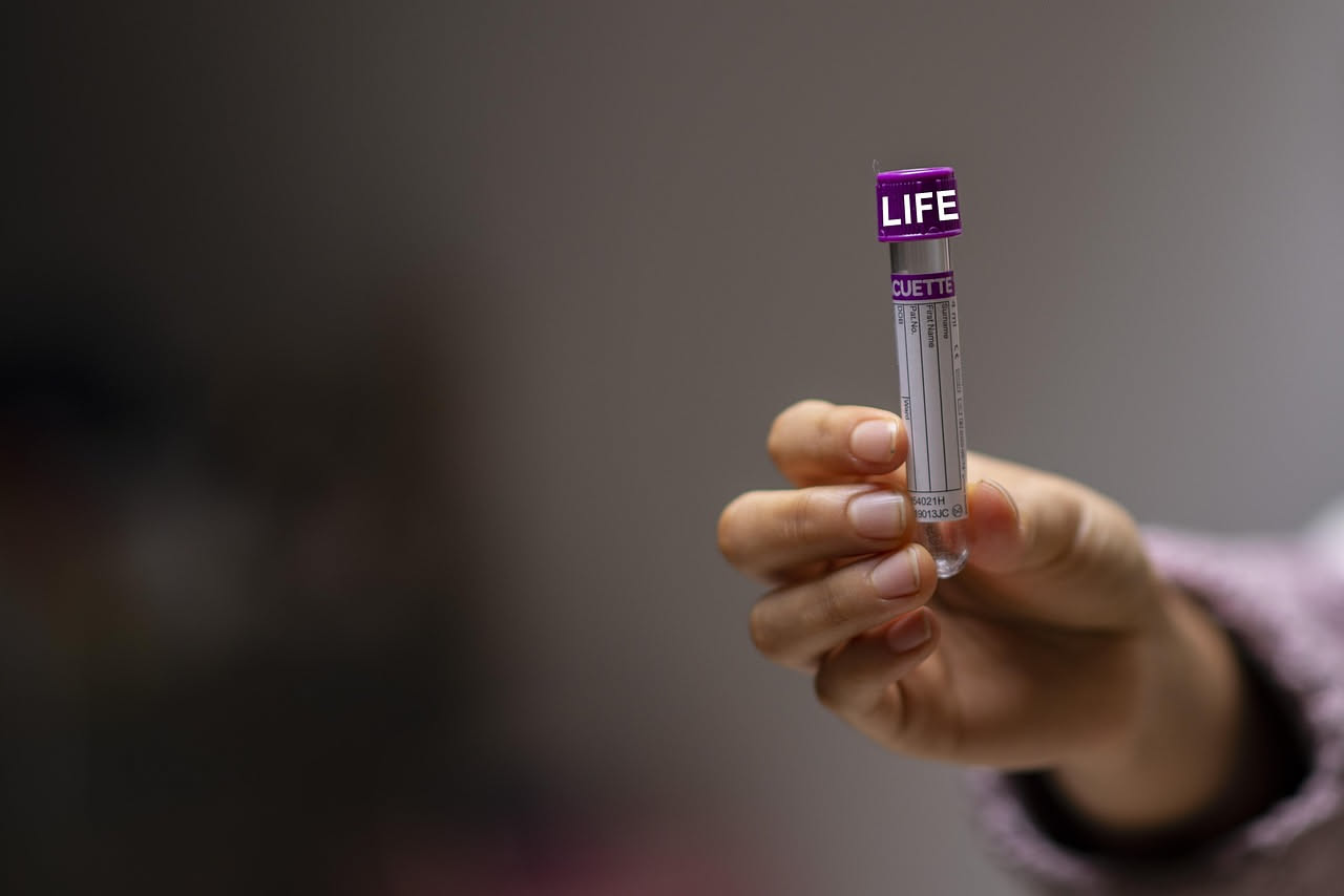 Test del sangue occulto fecale: come prepararsi davvero